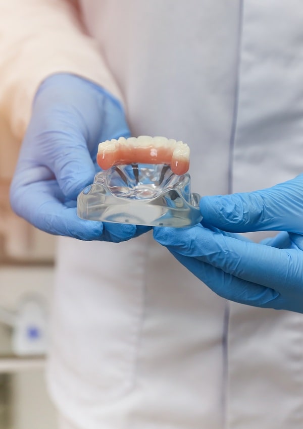 dental-crowns